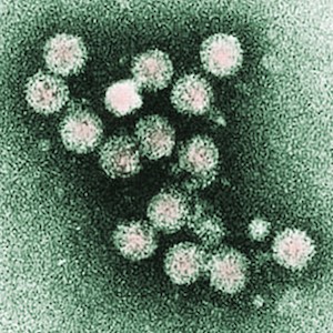 "Hepatitis C Virus (HCV)" by AJ Cann. Licensed under CC BY-SA 2.0.